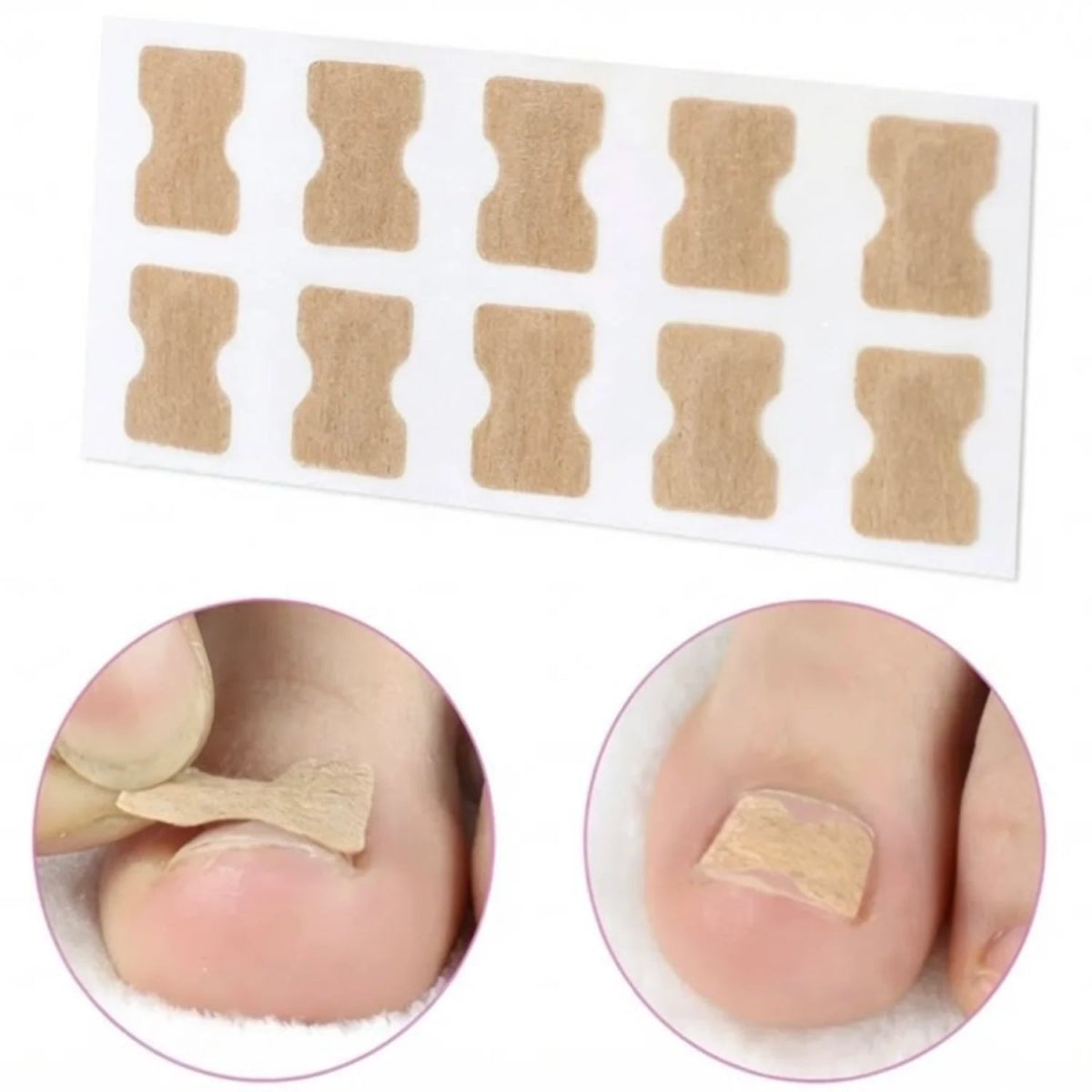 NailFix Ultra™️: Parche Corrector de Uñas - jomaka.cl